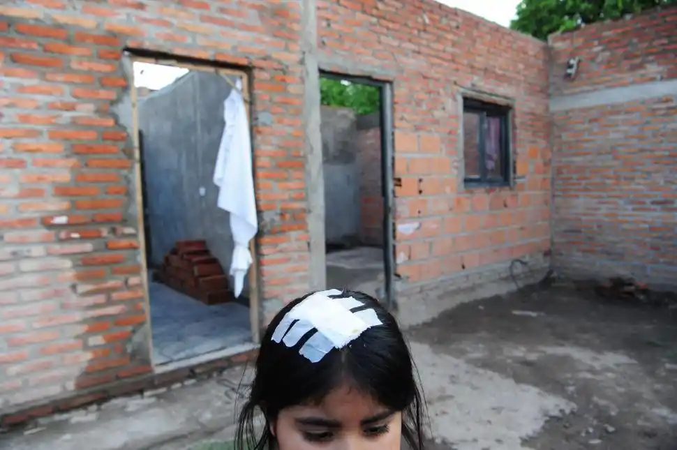 NAHIARA. La niña, con una venda en la cabeza en su casa inhabitable.