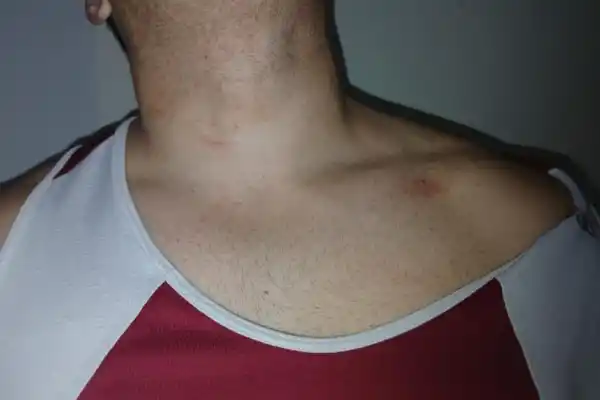 Denuncian otra agresión de patovicas a la salida de un boliche