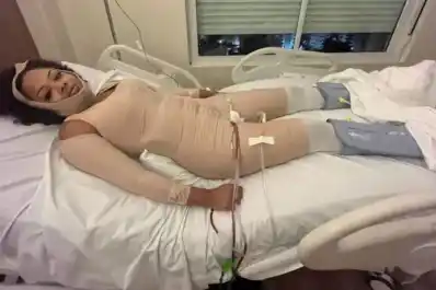 Una mujer se sometió a 12 cirugías estéticas en un solo día y terminó en terapia intensiva: condenaron al médico