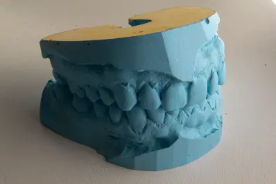 Cómo acceder al servicio de periodoncia que ofrece la Universidad Nacional de Tucumán