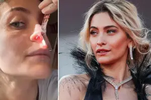 Paris Jackson mostró el “hueco en la nariz” que le dejó el abuso de drogas: Podría pasar un fideo