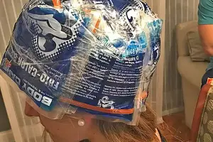 Cascos fríos Tucumán, la iniciativa que ayuda a pacientes oncológicos a conservar su pelo y que hoy necesita apoyo