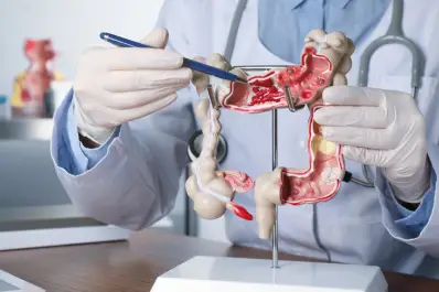 Cáncer colorrectal, el segundo de mayor mortalidad en Argentina: cómo prevenirlo