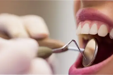 Cuál es el tratamiento dental que reduce el riesgo de diabetes y enfermedades cardíacas