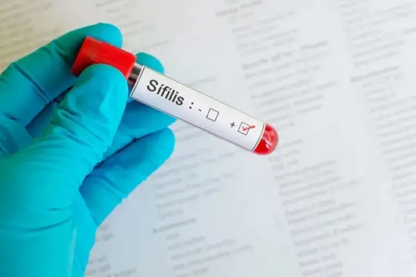 Sífilis, la patología del pasado que marca récords de contagios