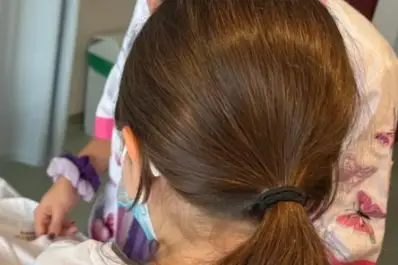 Una niña fue al hospital por un fuerte dolor de ojo y le encontraron gusanos en la cabeza