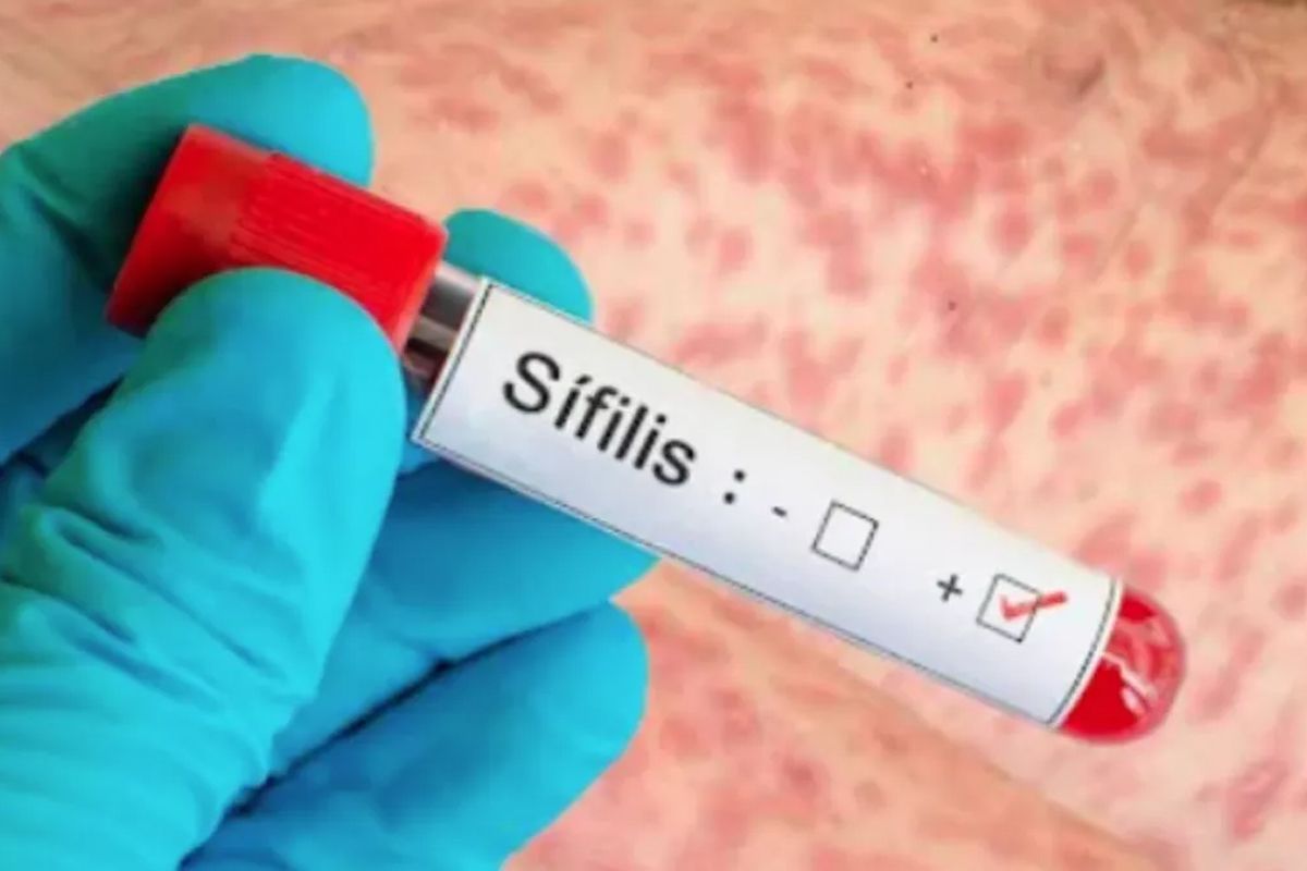 Diagnóstico y prevención de sífilis en atención primaria