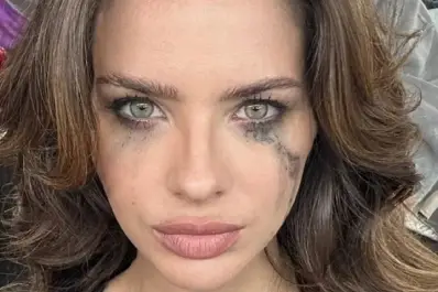 La China Suárez se quebró la nariz en pleno rodaje: ¿cómo quedó tras el golpe?