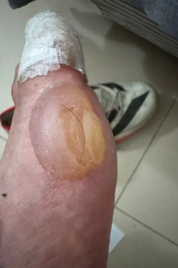 El pie de Rodríguez, con la secuelas de la competencia. 