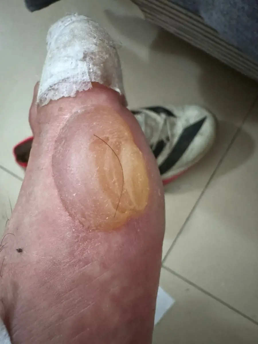 El pie de Rodríguez, con la secuelas de la competencia. 