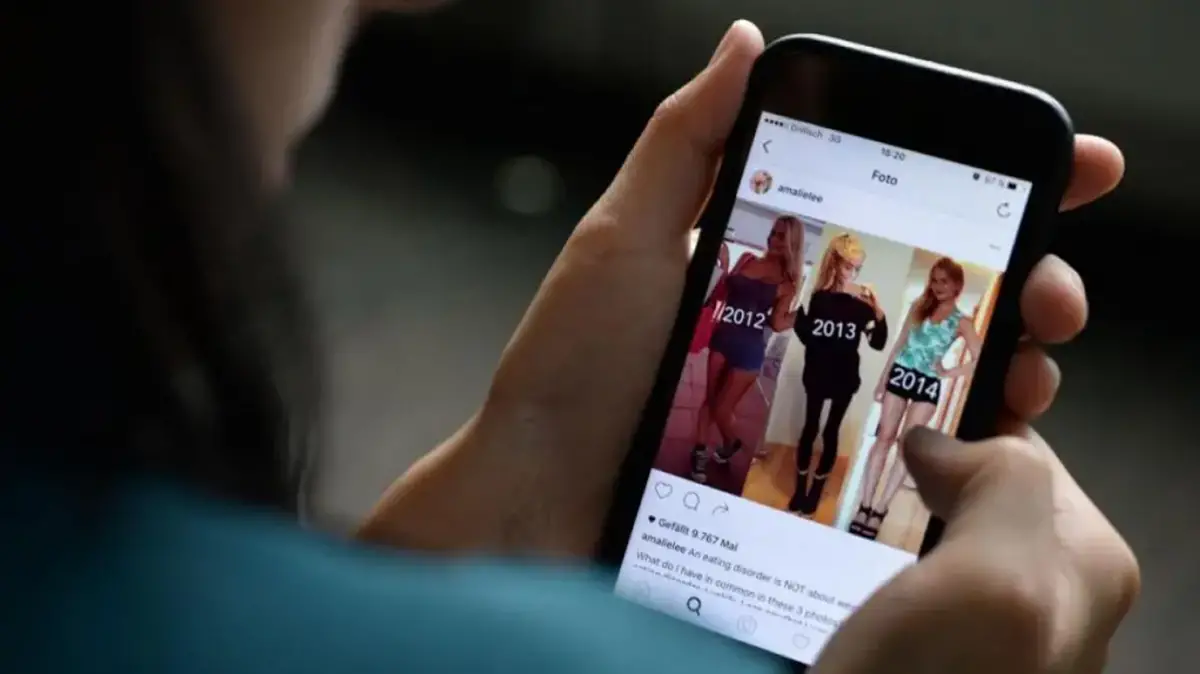 TRASTORNOS ALIMENTICIOS. El estudio de una universidad polaca señala la dieta restrictiva y la comparación en redes como los factores más determinantes. / PEXELS