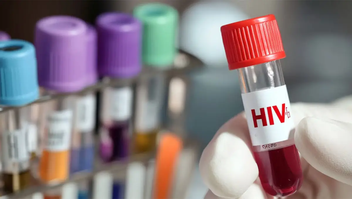 Día Mundial del Sida: el 13% de los argentinos con VIH desconoce que está infectado