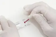 Por qué hoy se conmemora el Día Mundial del Sida y cómo se vive en Tucumán