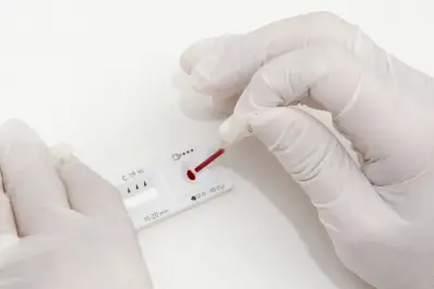 Por qué hoy se conmemora el Día Mundial del Sida y cómo se vive en Tucumán