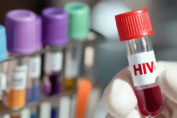 Día Mundial del Sida: el 13% de los argentinos con VIH desconoce que está infectado