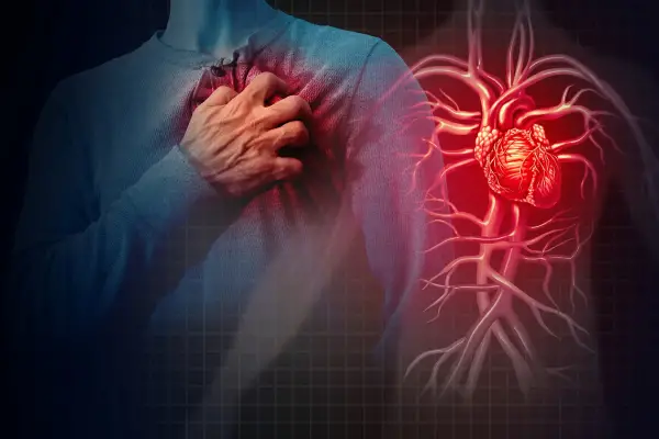 Joaquín Levinton internado: ¿qué es un infarto de miocardio y cómo prevenirlo?