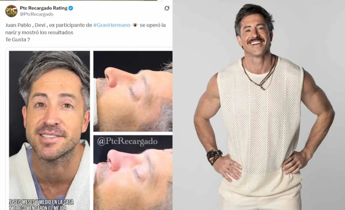 Impacto en las redes: un ex Gran Hermano pasó por el quirófano y su cambio físico generó controversia