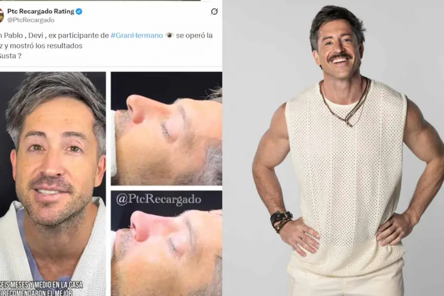 Impacto en las redes: un ex Gran Hermano pasó por el quirófano y su cambio físico generó controversia