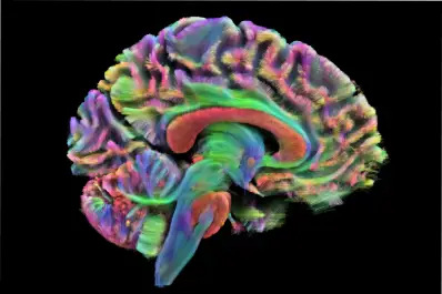 El cerebro se reinicia en cuatro edades clave: el sorprendente descubrimiento de la ciencia