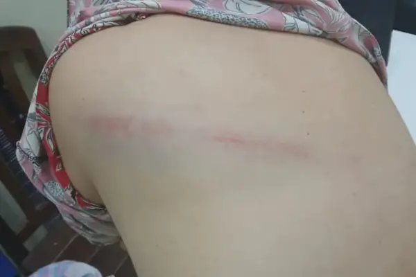 Violencia de género en Santiago del Estero: su esposo la golpeó con un látigo porque no le gustó cómo cebó el mate