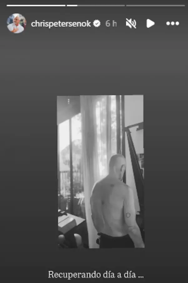Tras 26 días en terapia intensiva, Christian Petersen mostró cómo avanza su recuperación