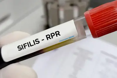 Alerta sanitaria en Argentina: los casos de sífilis crecieron un 71% y marcan un récord histórico