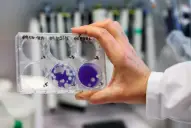 Salud confirmó el primer caso de gripe A H3N2 subclado K en Tucumán