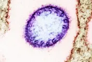 Estado de alerta en India: ¿qué es el Nipah y cómo se contagia?