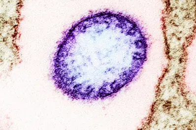 Estado de alerta en India: ¿qué es el Nipah y cómo se contagia?