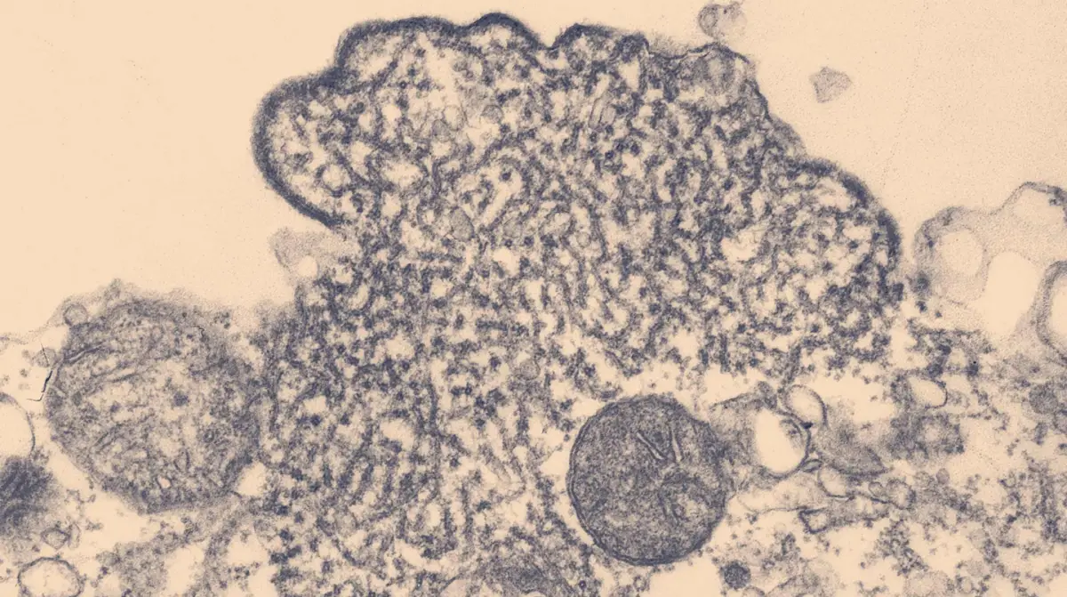 La OMS declaró que el riesgo de expansión es bajo.
