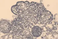 ¿Cuál es el riesgo de expansión del virus Nipah?: esto dice el nuevo informe de la OMS