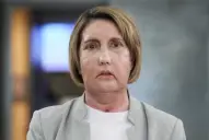 Primer trasplante de cara del mundo con donante por eutanasia: cómo fue la operación y por qué es histórica