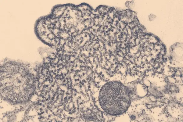 ¿Cuál es el riesgo de expansión del virus Nipah?: esto dice el nuevo informe de la OMS