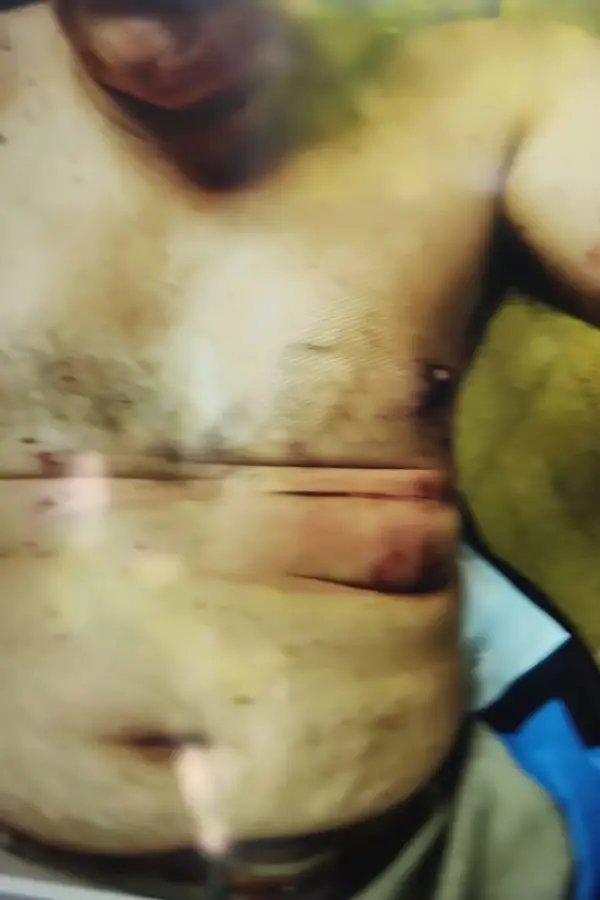 Uno de los heridos sufrió heridas en el torso y el brazo izquierdo. (Foto: TN.)