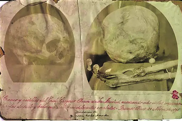 Recuerdos fotográficos: el cráneo La Madrid tenía “más cicatrices que hueso”