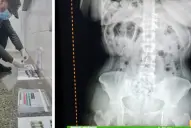 Detienen a tres “cápsuleras” que habían ingerido más de dos kilos de cocaína en Tucumán