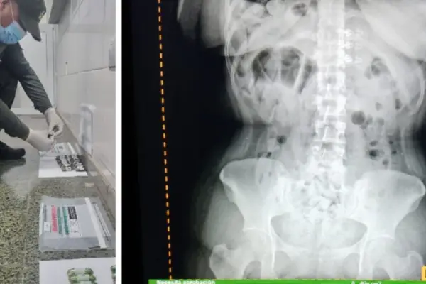 Detienen a tres “cápsuleras” que habían ingerido más de dos kilos de cocaína en Tucumán