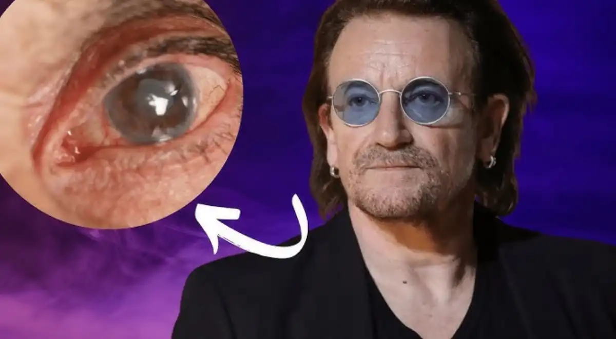 FAMOSO. Bono de U2 al ser tan famoso generó conciencia sobre la enfermedad en miles de personas que no la conocían. 