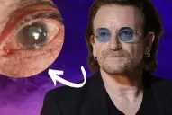 Para un mundo libre de glaucoma es necesaria la detección temprana