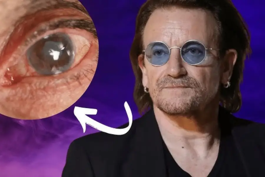 FAMOSO. Bono de U2 al ser tan famoso generó conciencia sobre la enfermedad en miles de personas que no la conocían. 