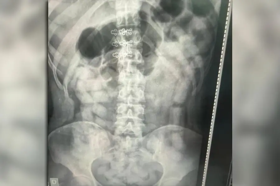 Llevaban 500 cápsulas de cocaína en el estómago: detuvieron a seis “mulas” en el límite entre Tucumán y Catamarca