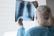 Nuevas normativas para el seguimiento de la tuberculosis: cómo prevenirla en medio del aumento de casos