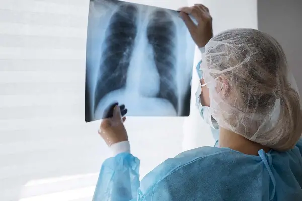Nuevas normativas para el seguimiento de la tuberculosis: cómo prevenirla en medio del aumento de casos