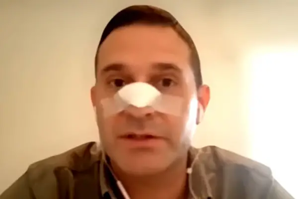 Pelli pide que se investigue a los policías que actuaron tras la agresión de Segura