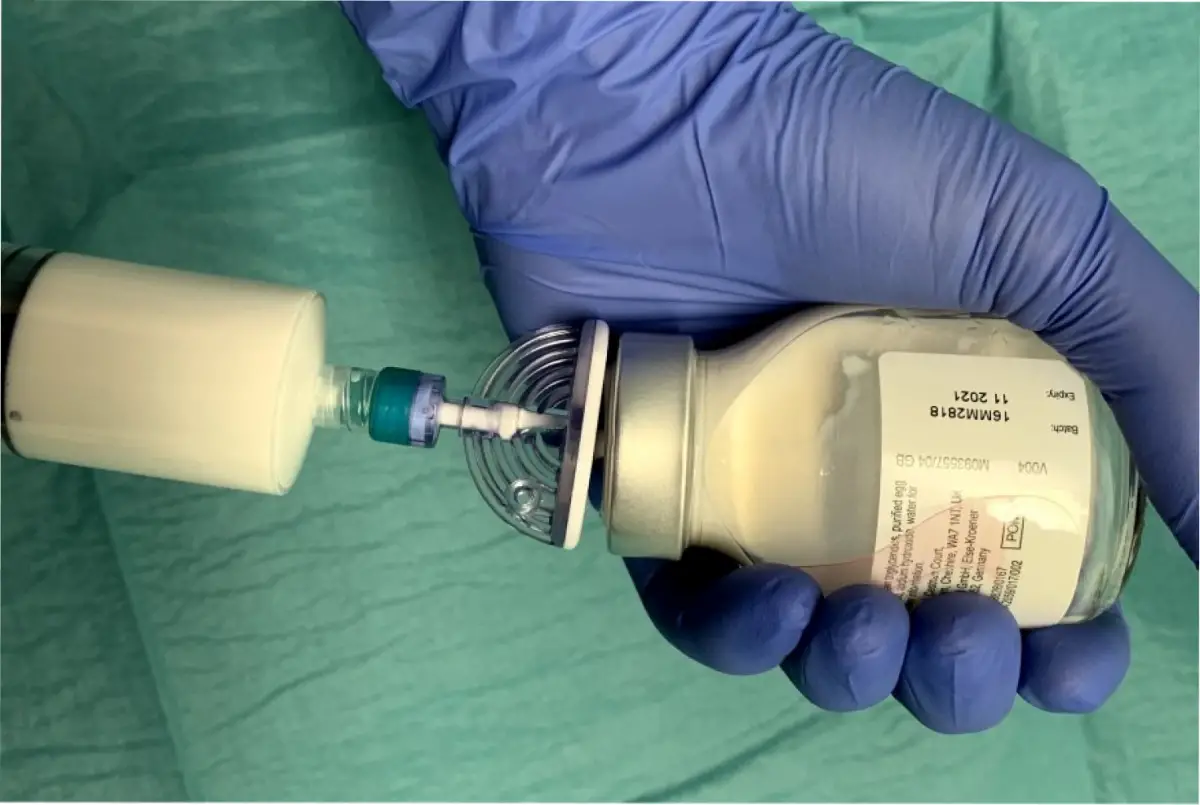 El propofol, un medicamento clave en anestesia.