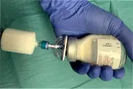 Qué es el propofol: un especialista explica cuándo puede ser medicamento y cuándo se vuelve peligroso