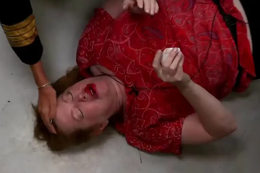 Andrea del Boca sufrió una fuerte caída en GH y se lastimó la boca