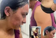 Piden la detención de las mujeres que agredieron a otra en un partido de hockey