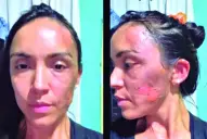 Luis Ledesma, sobre el ataque en Universitario: “Es una realidad que no conoce de clubes ni de disciplinas deportivas”