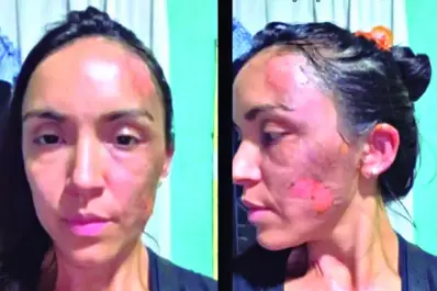 Luis Ledesma, sobre el ataque en Universitario: “es una realidad que no conoce de clubes ni de disciplinas deportivas”